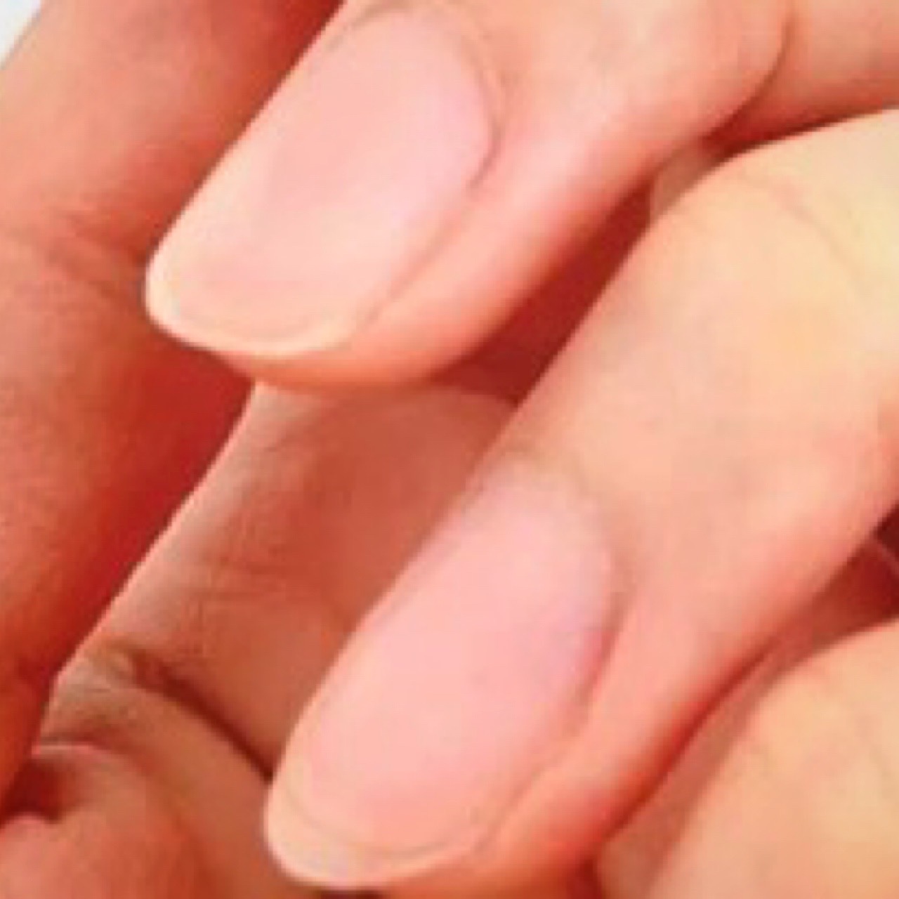 亀裂補強の画像